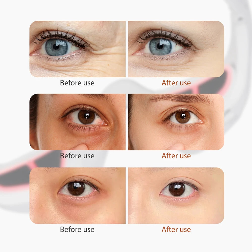 Red Light Eye Massager